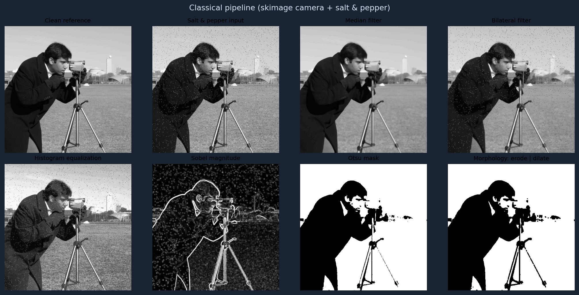 Eight-panel classical pipeline: clean, noisy, median, bilateral, hist eq, Sobel, Otsu, morphology